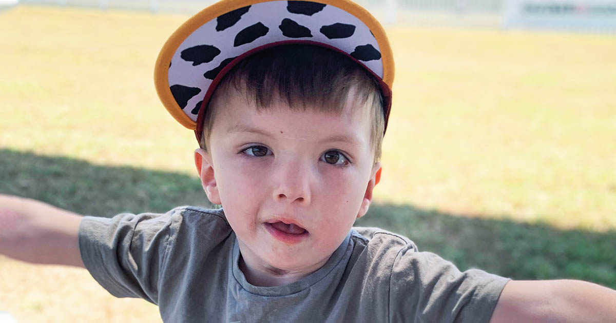 George has Moebius Syndrome